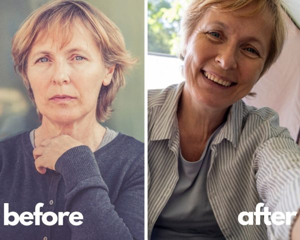 Sermorelin Results of Our Patients | Before and After Pics