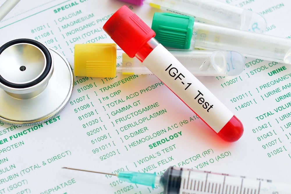 How Patients Can Test Their IGF-1 Levels