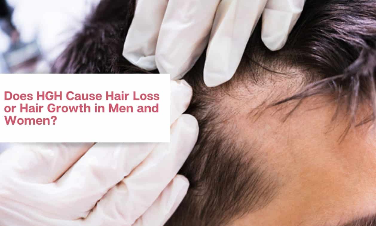 Does HGH Cause Hair Loss or Hair Growth in Men and Women (FI)