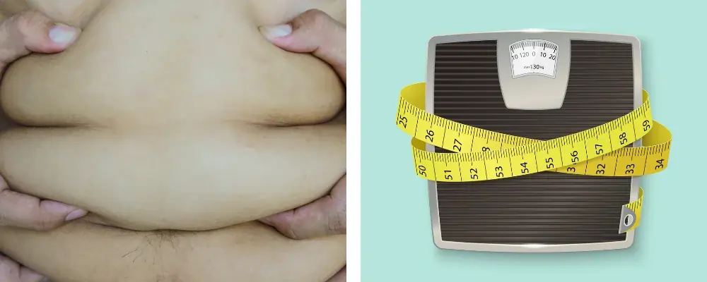 TRT and stubborn belly fat