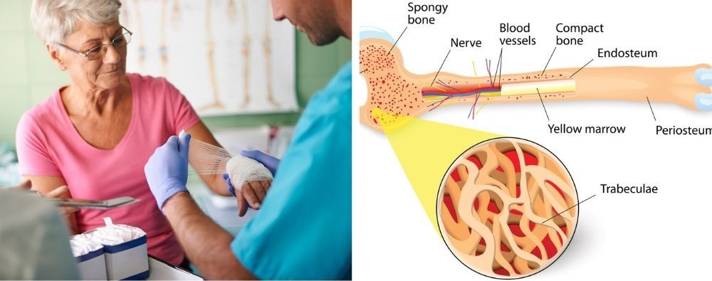 The effect of growth hormone on bone tissue repair