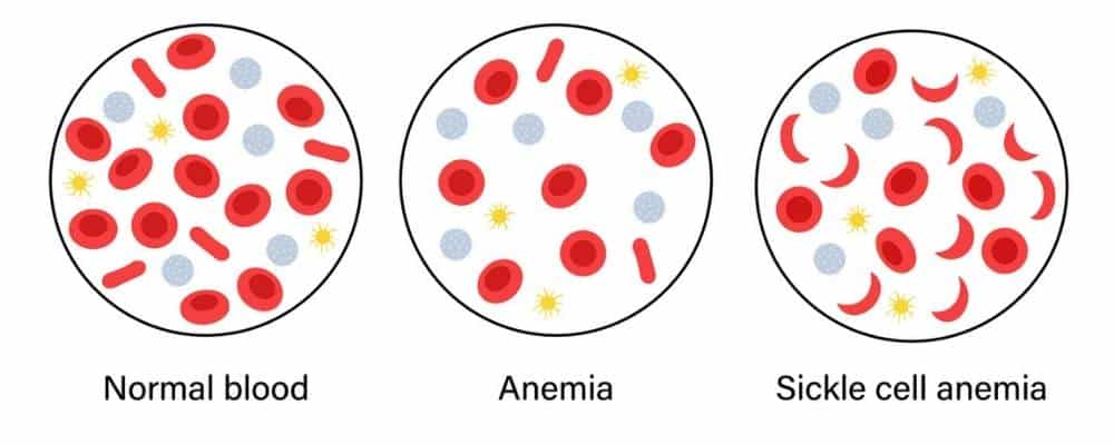 here's how amenia looks like