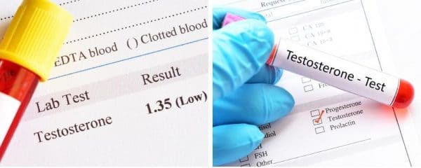 How To Stop Premature Ejaculation: Prevention & Cure